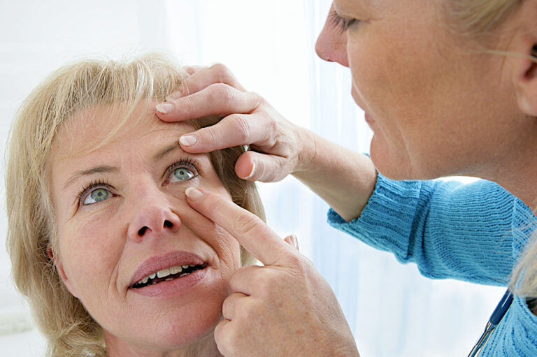 Dry age-related macular degeneration – Signs and management
